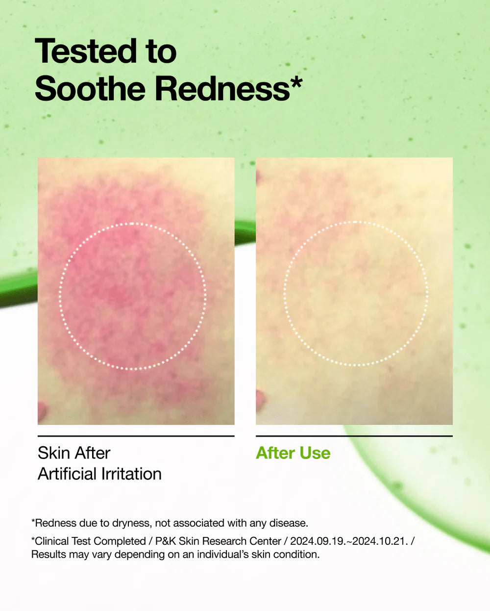 Anua - Azelaic Acid 10 Hyaluron Redness Soothing Serum - Korean skincare - Nashwa